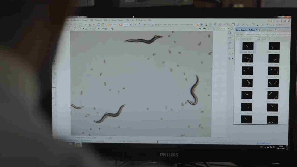Imágenes al microscopio bacterias del proyecto Parabiotics. CEDIDA